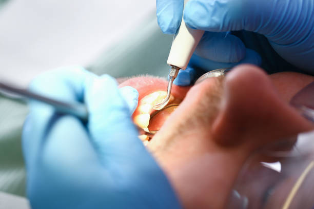 Best Emergency Dental Care for Broken or Chipped Teeth in Preston Heights, IL