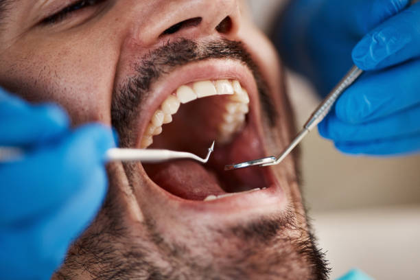 Best Emergency Tooth Extraction in Preston Heights, IL